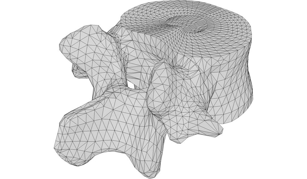 CM2 Intersect® T3 - Vertebra - Initial Mesh